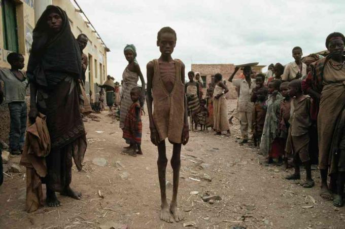 Ofiary głodu wywołanego wojną domową w Somalii.